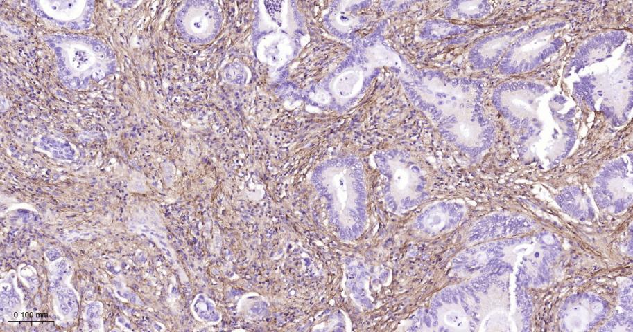 Ⅲ型胶原蛋白重组兔单抗
