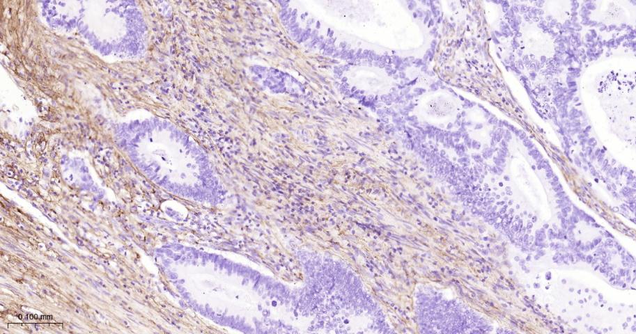 III型胶原单克隆抗体-bsm-33129M