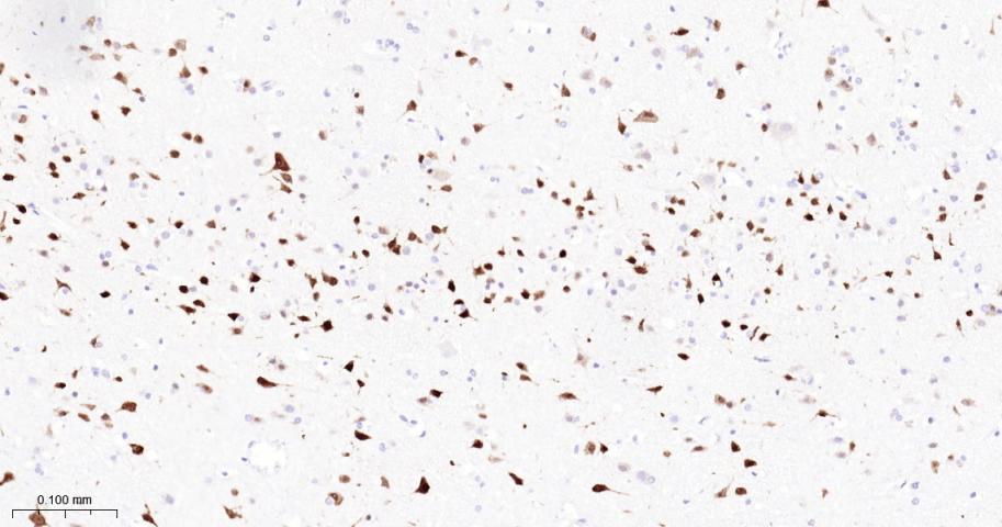 神经元核抗原重组兔单抗