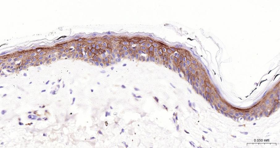 多配体蛋白聚糖1（CD138）单克隆抗体-bsm-43670M