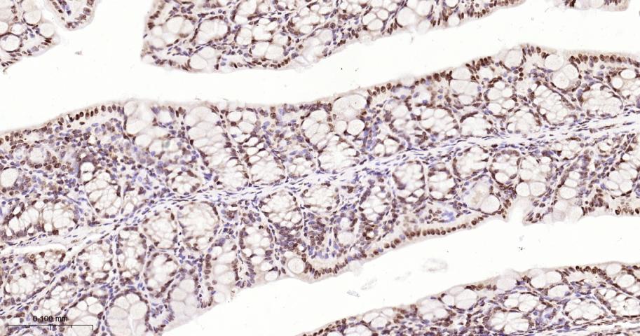 单甲基化组蛋白H3K18重组兔单抗