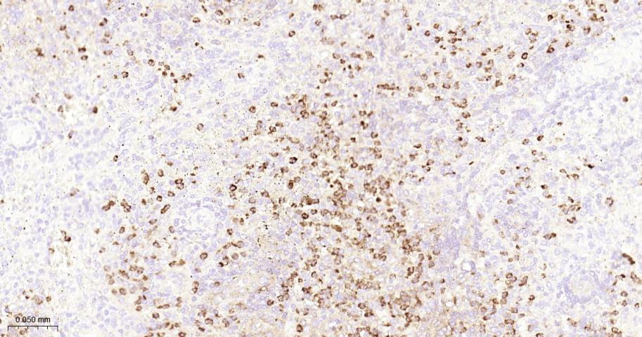 基质金属蛋白酶-9重组兔单抗