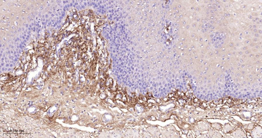 Ⅲ型胶原蛋白重组兔单抗