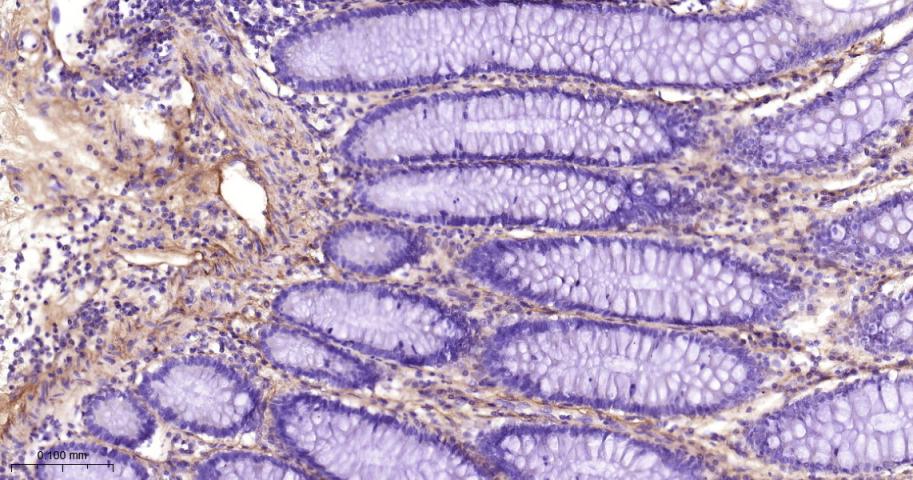 Ⅲ型胶原蛋白/胶原蛋白3/3型胶原蛋白/III型胶原抗体-bs-0549R
