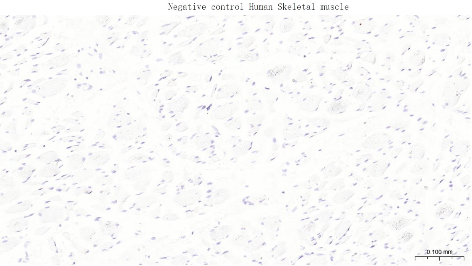 多配体蛋白聚糖1（CD138）单克隆抗体-bsm-43670M