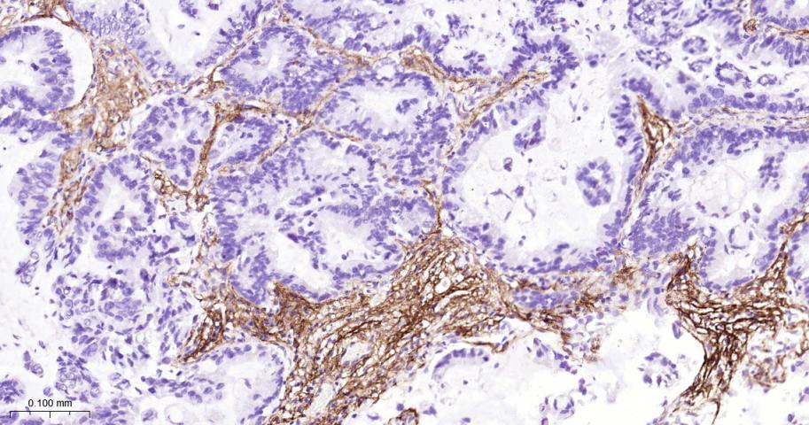 Ⅲ型胶原蛋白/胶原蛋白3/3型胶原蛋白/III型胶原抗体-bs-0549R