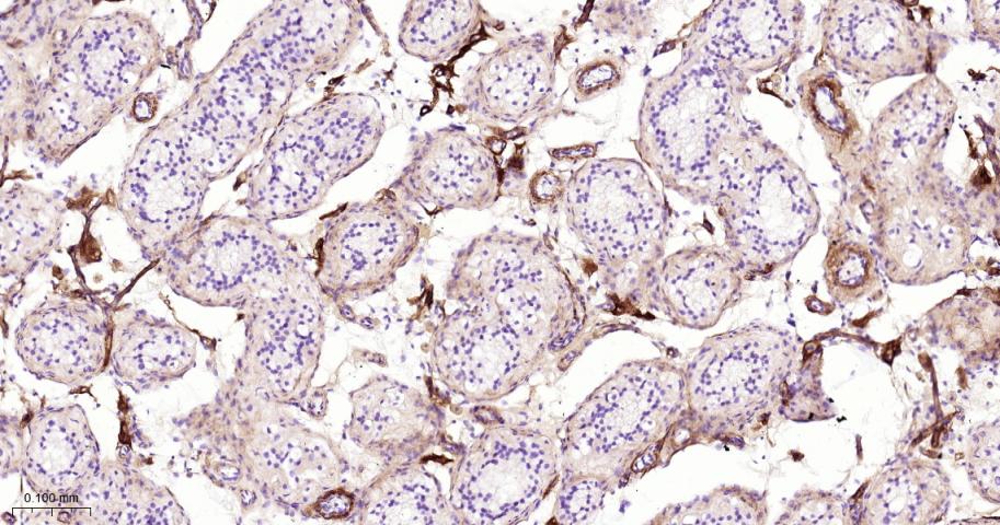 Ⅲ型胶原蛋白/胶原蛋白3/3型胶原蛋白/III型胶原抗体-bs-0549R