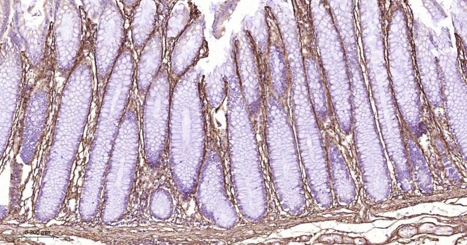Ⅲ型胶原蛋白重组兔单抗