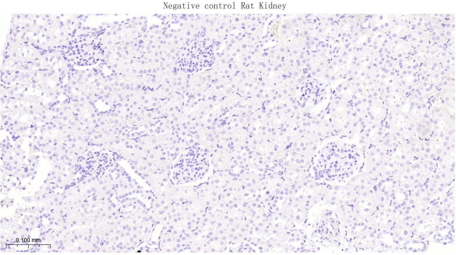 髓鞘碱性蛋白/磷脂碱性蛋白单克隆抗体-bsm-33932M