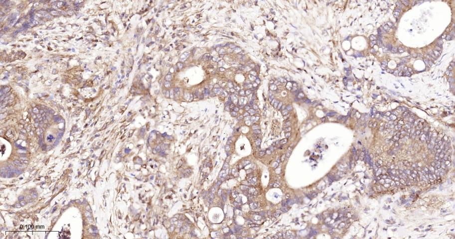蛋白激酶B重组兔单抗