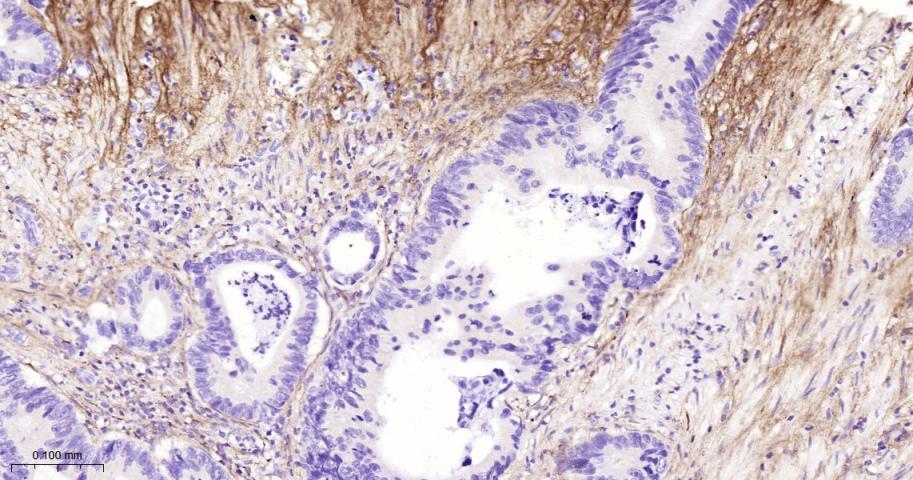 Ⅲ型胶原蛋白/胶原蛋白3/3型胶原蛋白/III型胶原抗体-bs-0549R