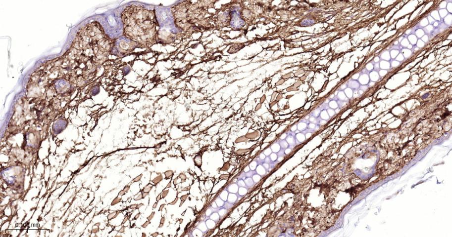 Ⅲ型胶原蛋白/胶原蛋白3/3型胶原蛋白/III型胶原抗体-bs-0549R
