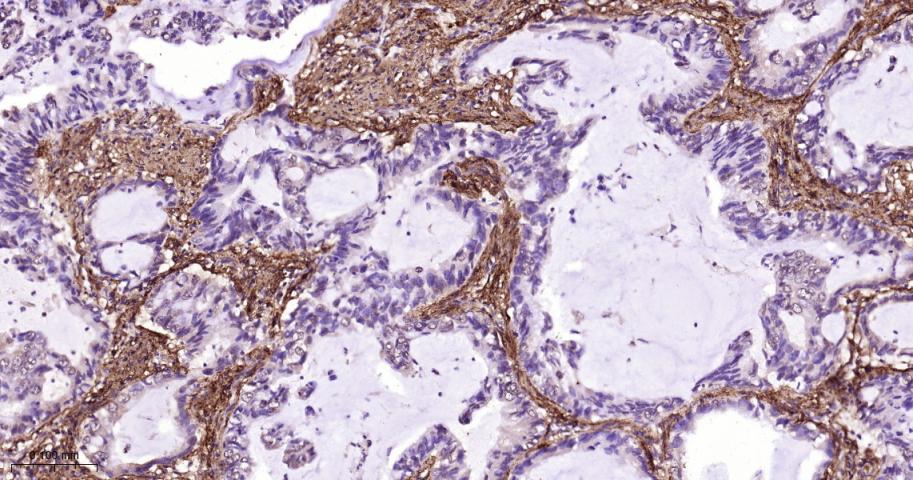 Ⅲ型胶原蛋白重组兔单抗