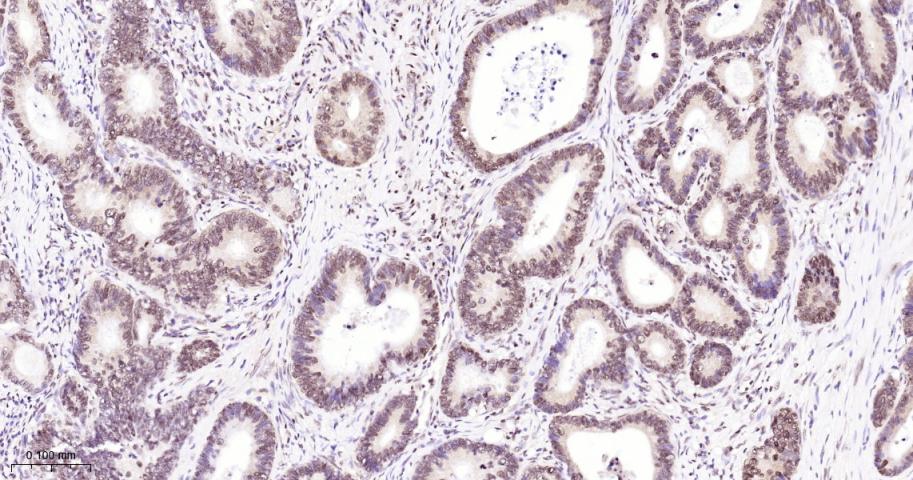 单甲基化组蛋白H3K18重组兔单抗