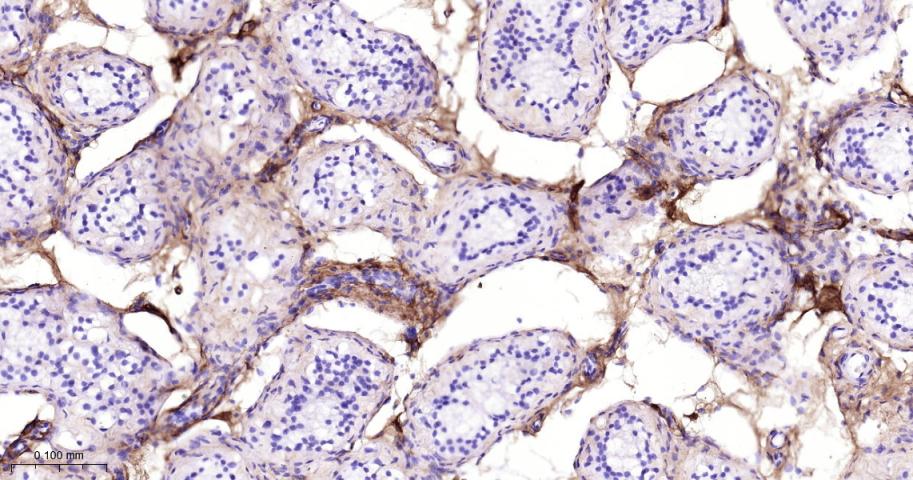 III型胶原单克隆抗体-bsm-33129M