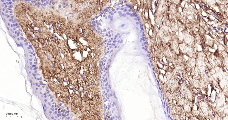 III型胶原单克隆抗体-bsm-33129M