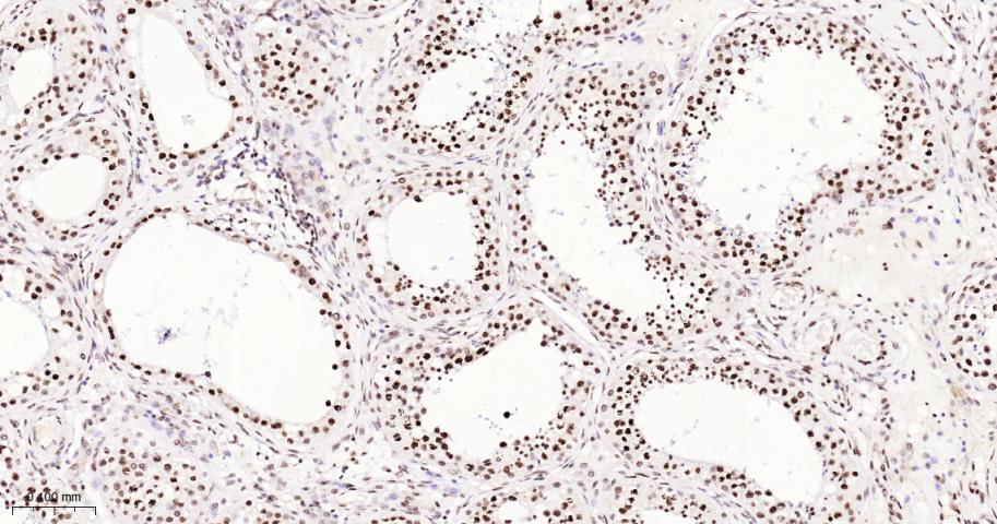 单甲基化组蛋白H3K18重组兔单抗