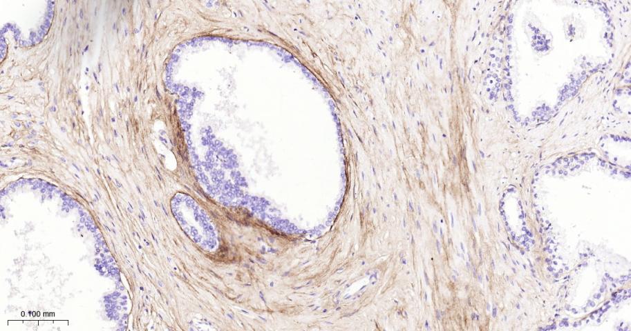 Ⅲ型胶原蛋白/胶原蛋白3/3型胶原蛋白/III型胶原抗体-bs-0549R