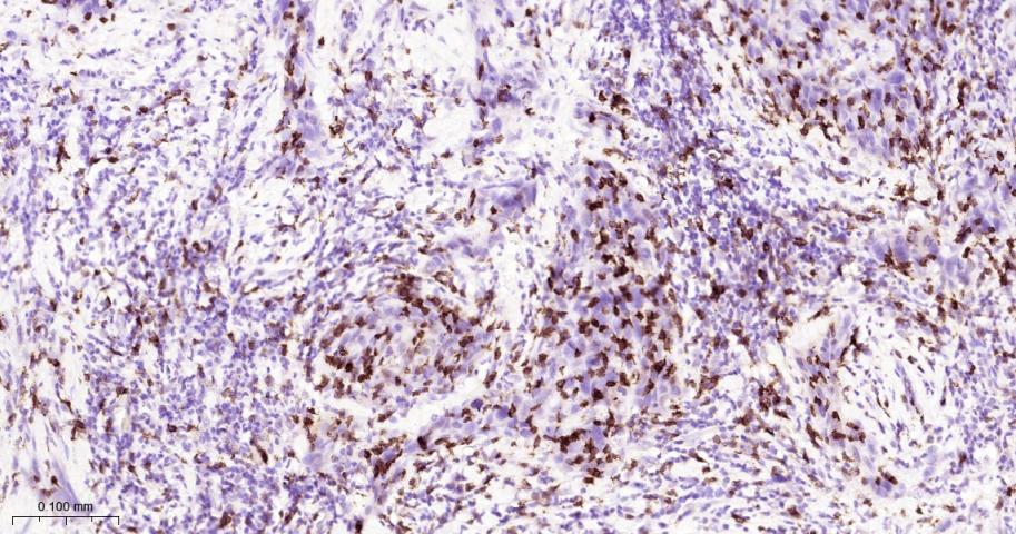 整合素αE重组兔单抗