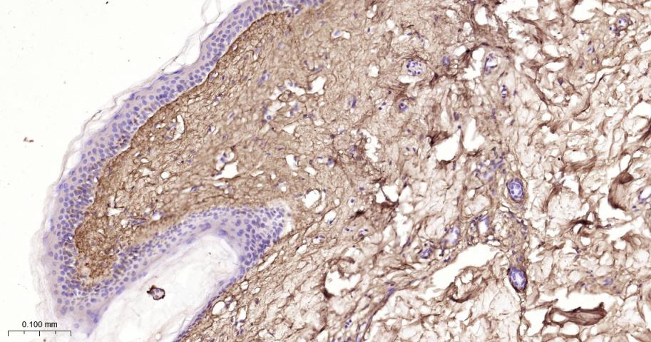 Ⅲ型胶原蛋白重组兔单抗
