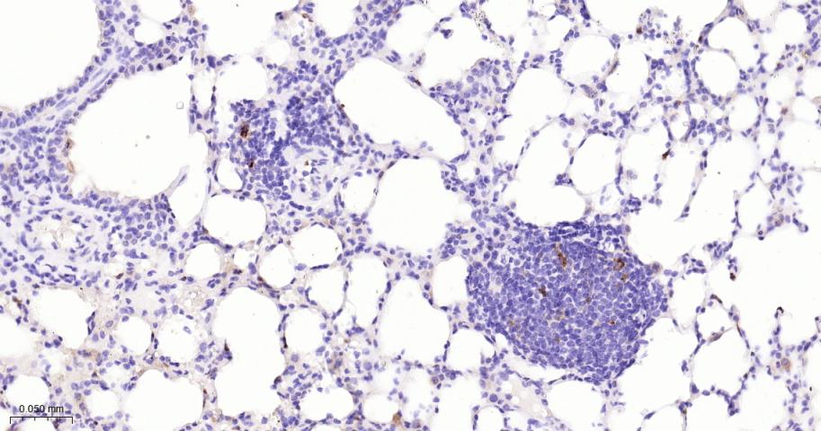基质金属蛋白酶-9重组兔单抗