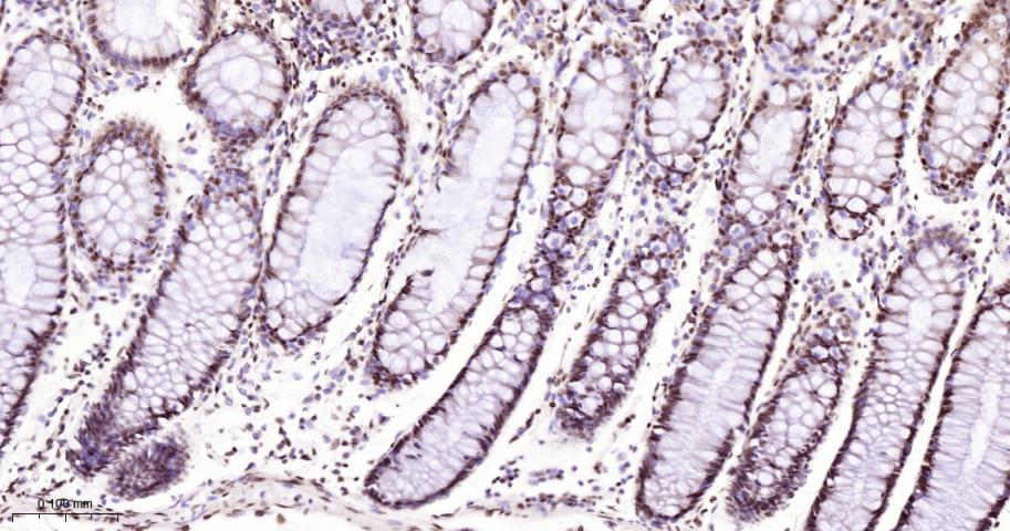 单甲基化组蛋白H3K18重组兔单抗