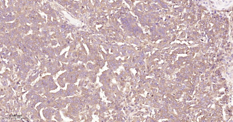 蛋白激酶B重组兔单抗