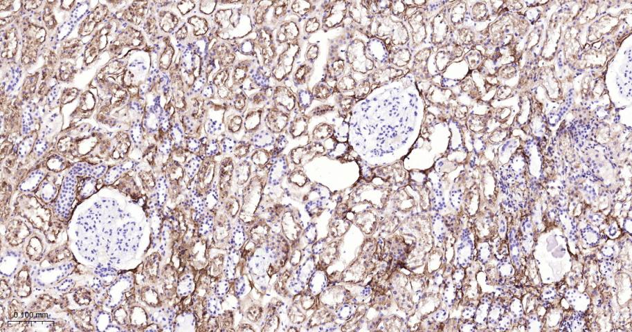 Ⅲ型胶原蛋白重组兔单抗
