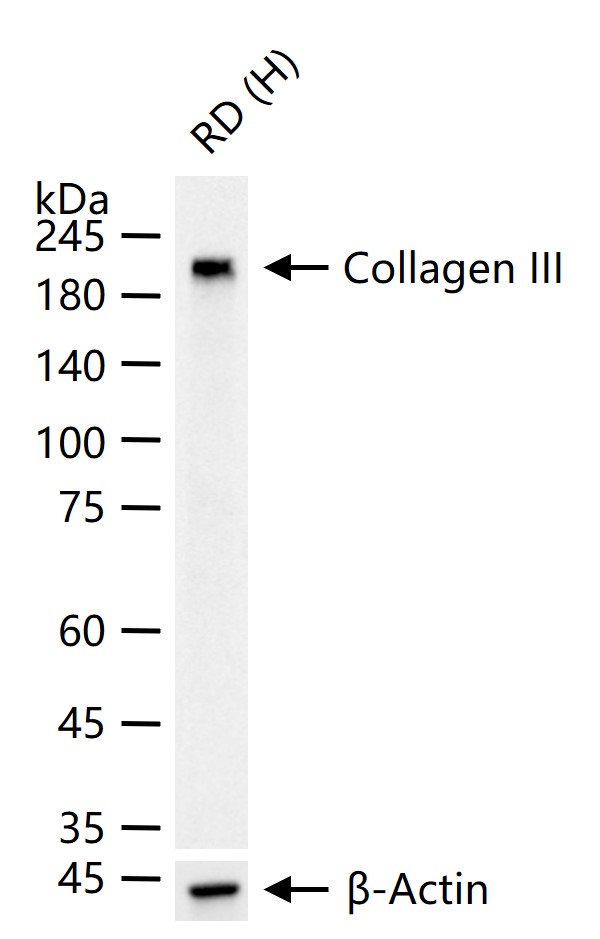 Collagen III Mouse mAb (一抗) - WB,IHC-P,IHC-F,IF,ICC/IF | Bioss