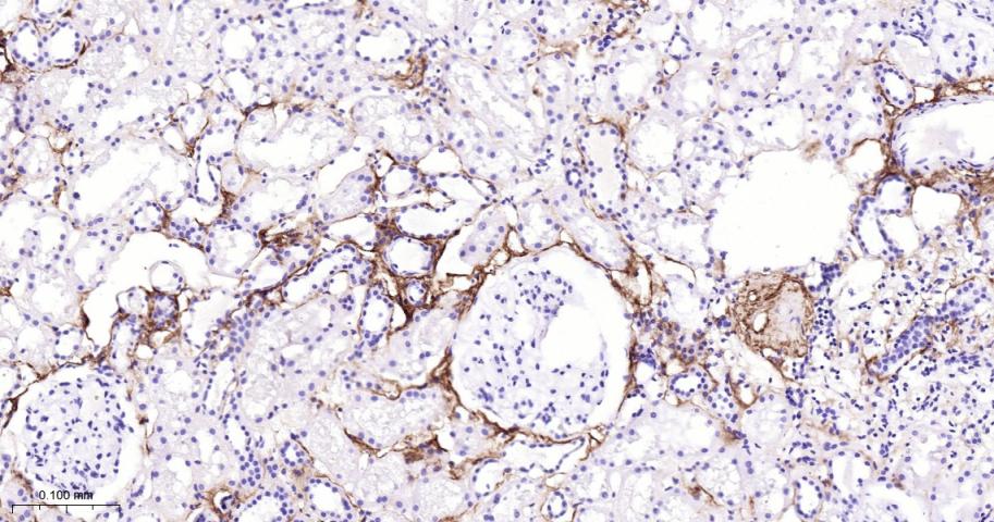 Ⅲ型胶原蛋白/胶原蛋白3/3型胶原蛋白/III型胶原抗体-bs-0549R