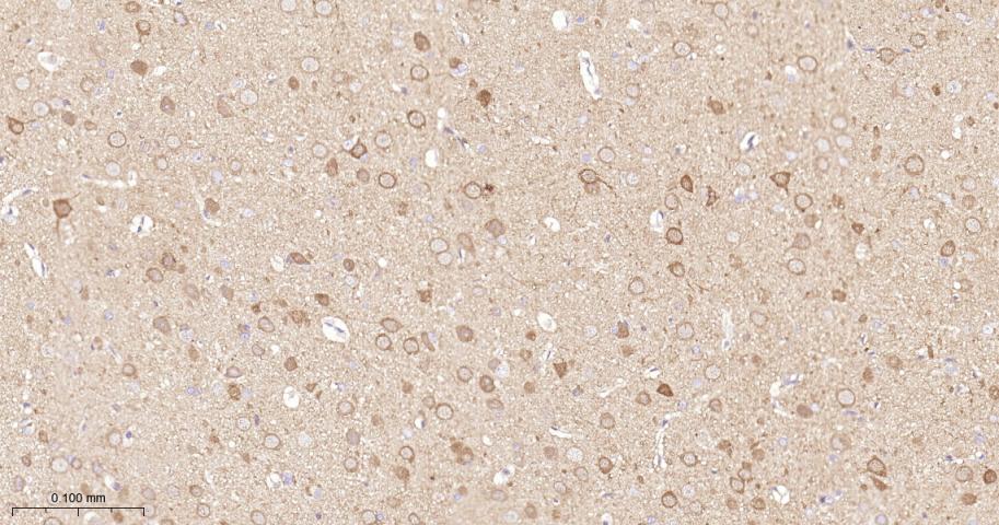 蛋白激酶B重组兔单抗