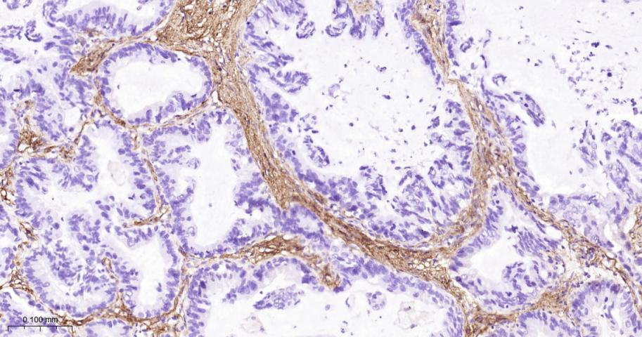 III型胶原单克隆抗体-bsm-33129M