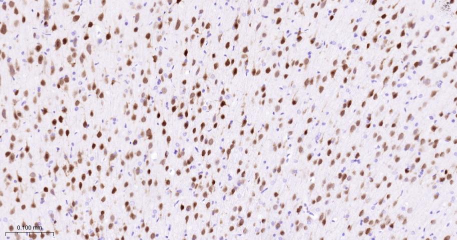 神经元核抗原重组兔单抗