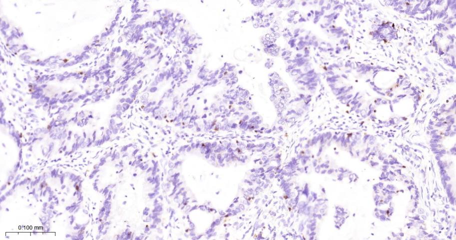 整合素αE重组兔单抗