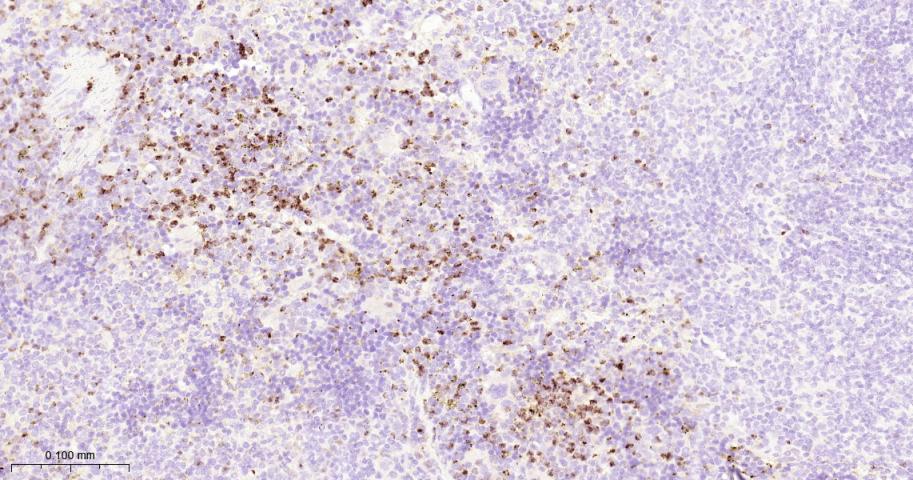 基质金属蛋白酶-9重组兔单抗