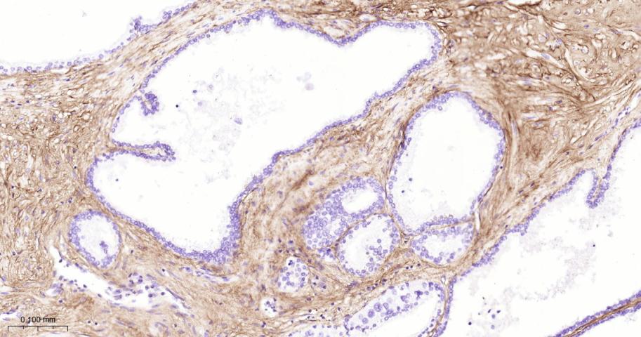 III型胶原单克隆抗体-bsm-33129M