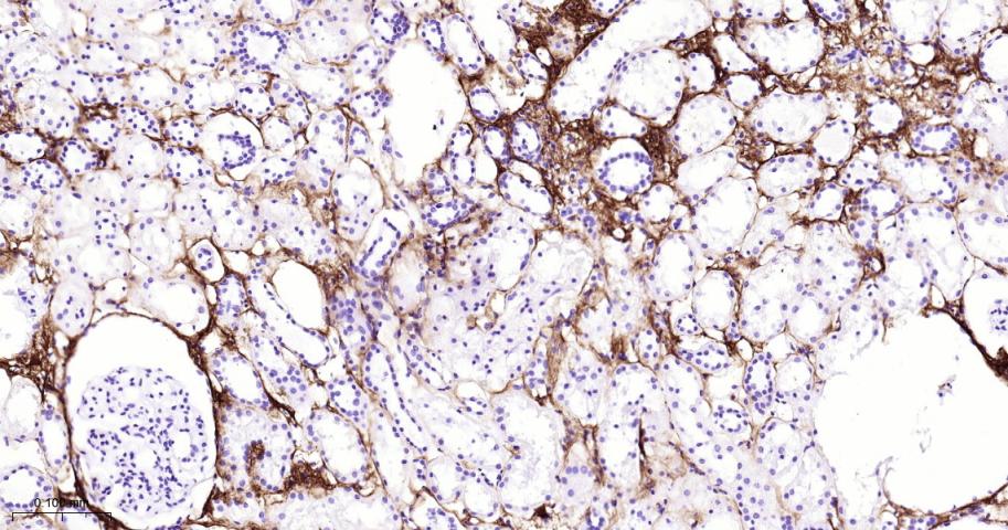 III型胶原单克隆抗体-bsm-33129M