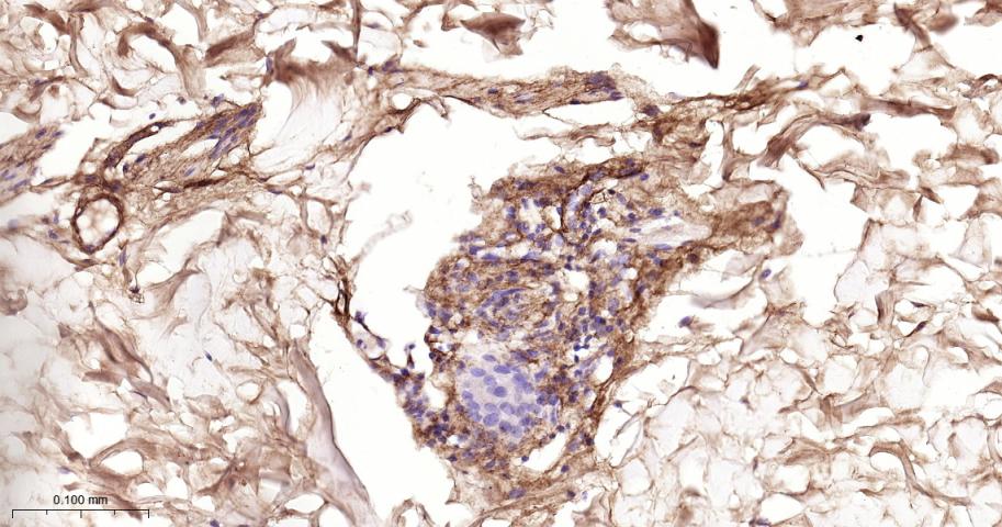 Ⅲ型胶原蛋白/胶原蛋白3/3型胶原蛋白/III型胶原抗体-bs-0549R