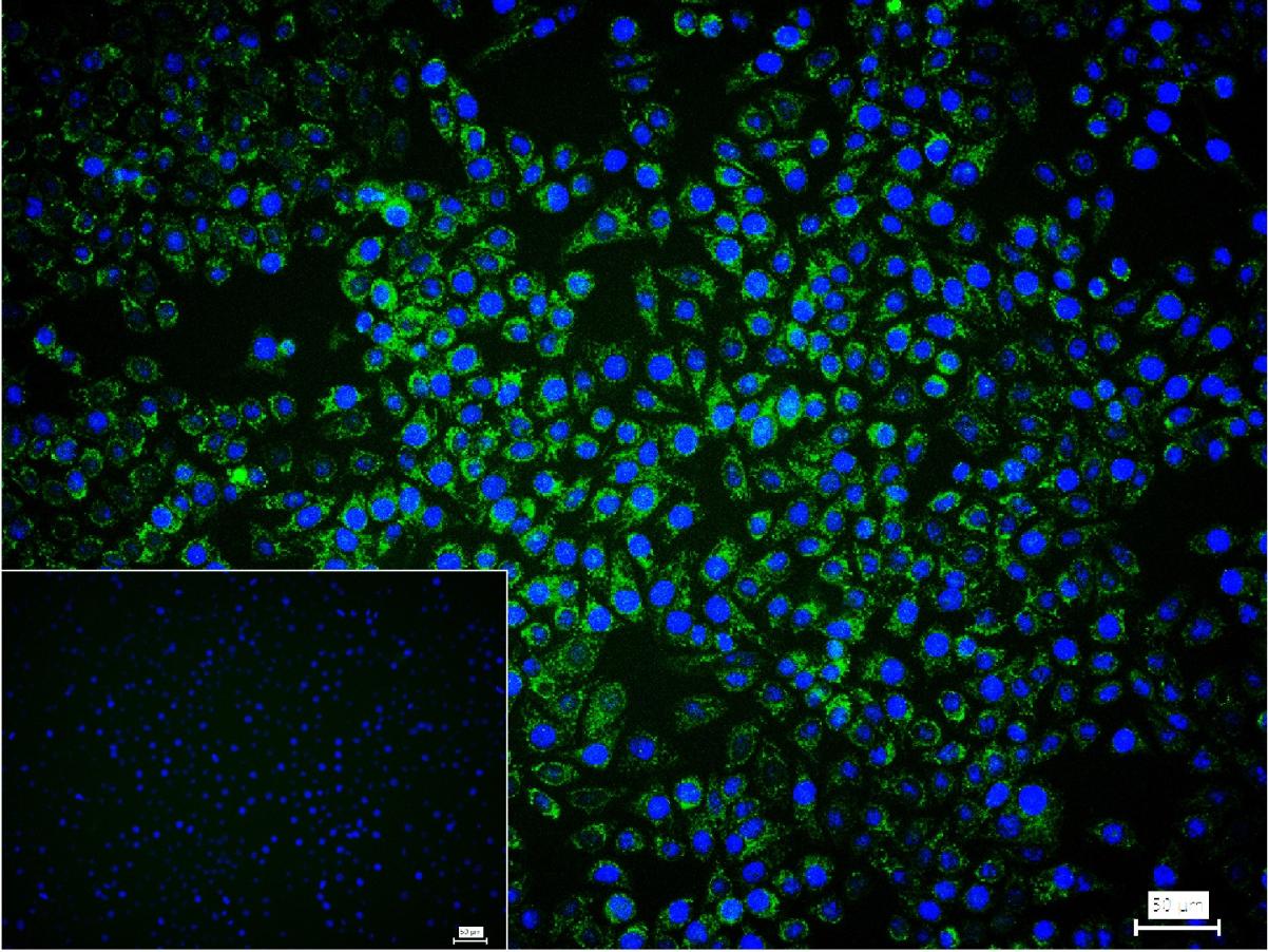 铬细胞瘤患者抑癌基因SDHB重组兔单抗