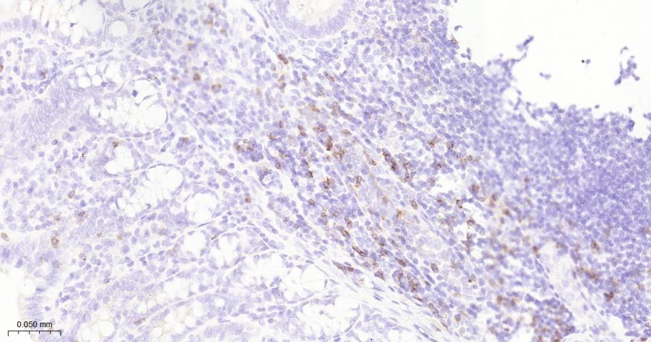 CD8 Rabbit pAb (一抗) - WB,IHC-P,IHC-F,IF | Bioss