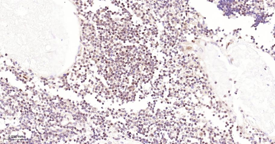 泛素特异性蛋白酶28重组兔单抗