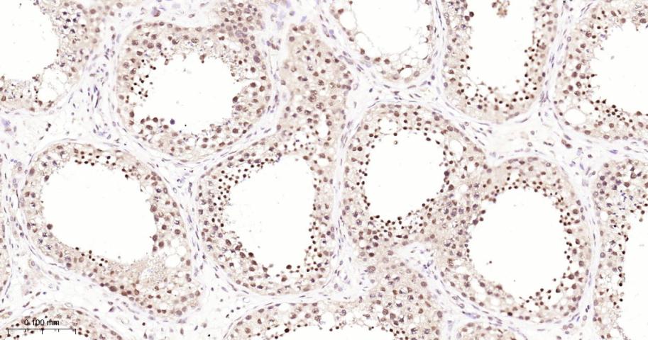 泛素特异性蛋白酶28重组兔单抗