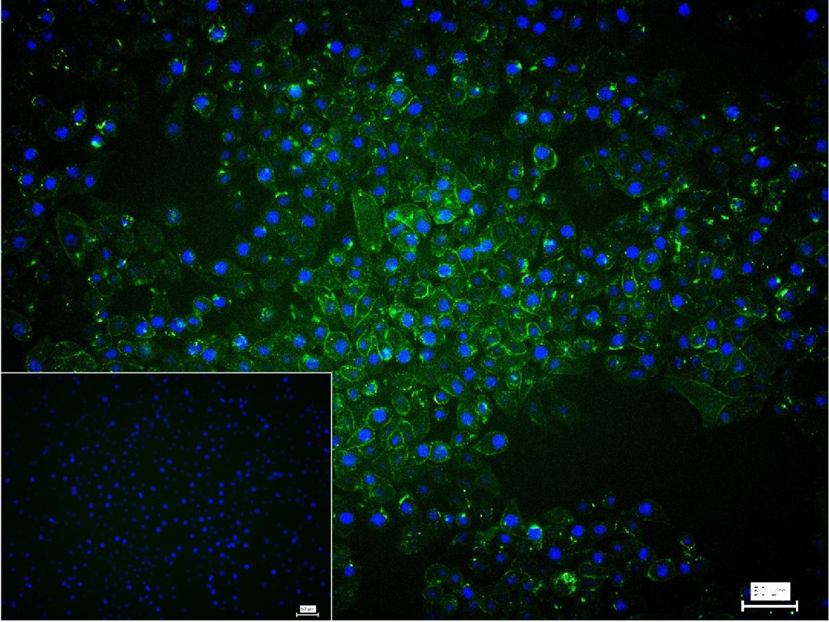 兔抗桥粒芯糖蛋白2单克隆抗体
