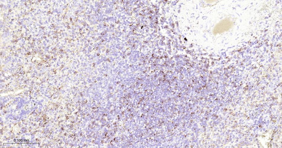 CD8A单克隆抗体-bsm-34251M