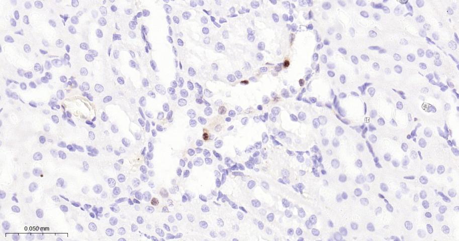 磷酸化丝裂原活化蛋白激酶1/2抗体