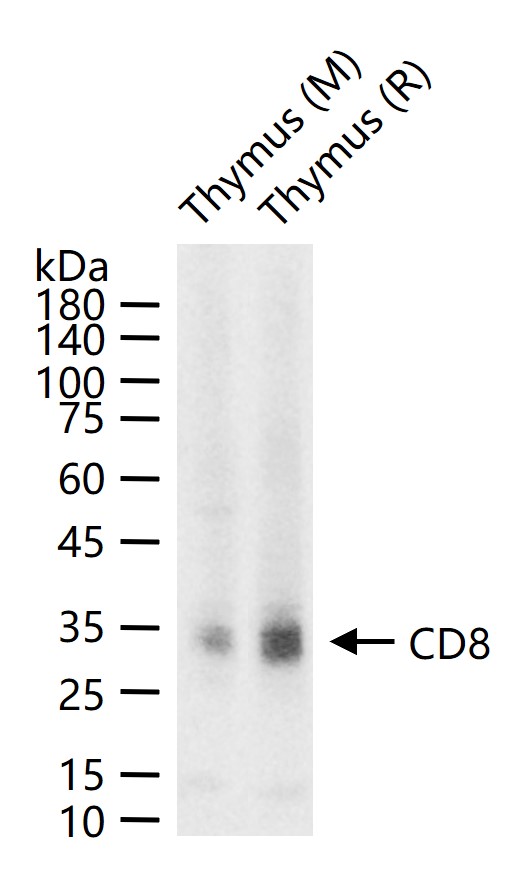 CD8 Rabbit pAb (一抗) - WB | Bioss