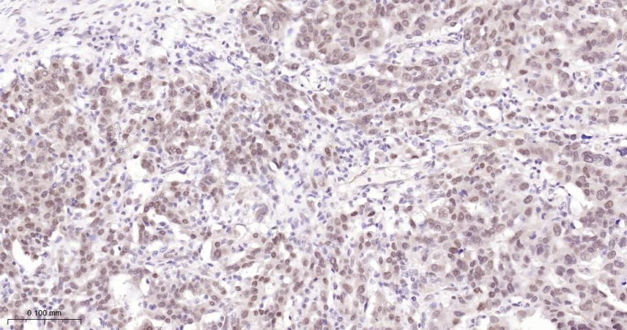 泛素特异性蛋白酶28重组兔单抗