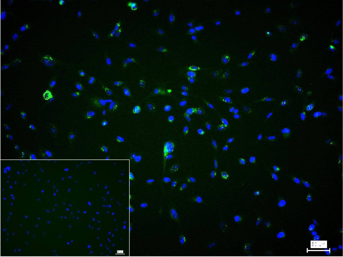 I型胶原蛋白/胶原蛋白1/1型胶原蛋白/I型胶原a1抗体