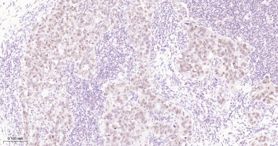 泛素特异性蛋白酶28重组兔单抗