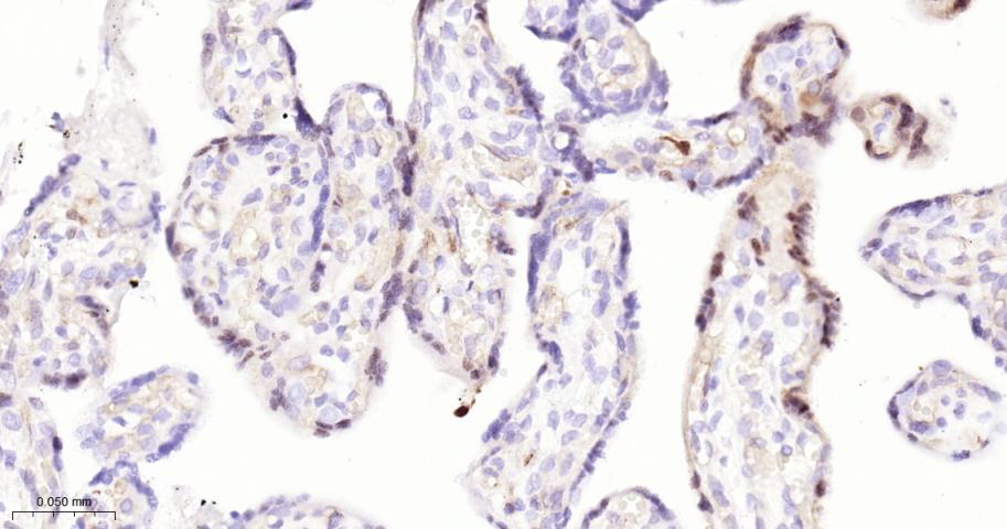 磷酸化丝裂原活化蛋白激酶1/2抗体